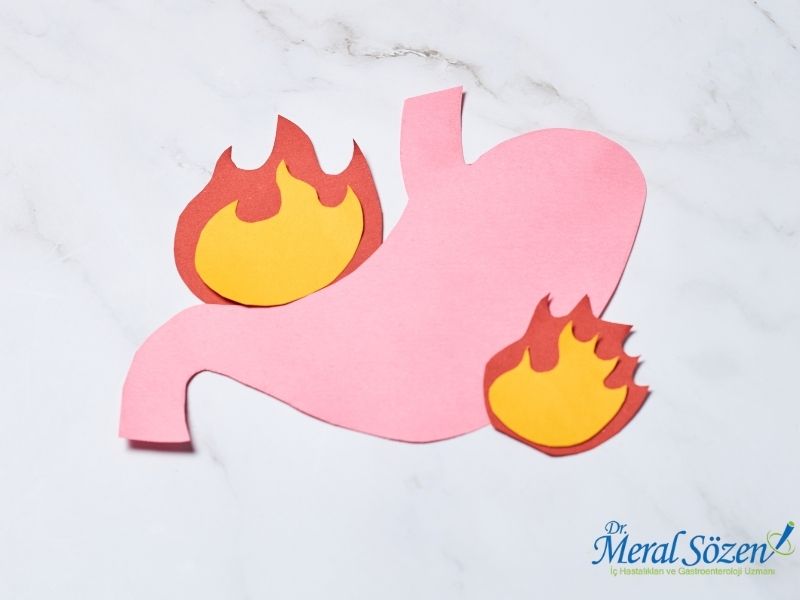 gastrit-tedavisi-ne-kadar-surer