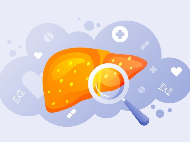 karaciger-yaglanmasi-tedavisi-ne-kadar-surer